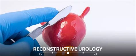 Managing Complications In Lahay Reconstructive Urology Practical Guide