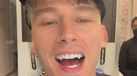 Machine Gun Kelly Unveils His New Diamond Studded Vampire Fangs And