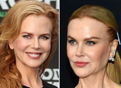 Nicole Kidman Amp 39 S Amp Quot Unrecognizable Amp Quot Face Leaving Fans Worried What Amp 39 S Happening To Her Face Marca