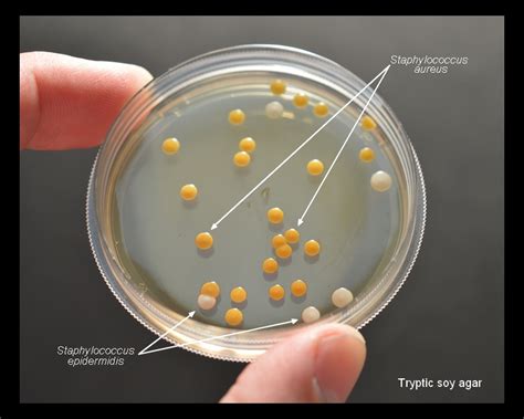 Staphylococcus Epidermidis Agar