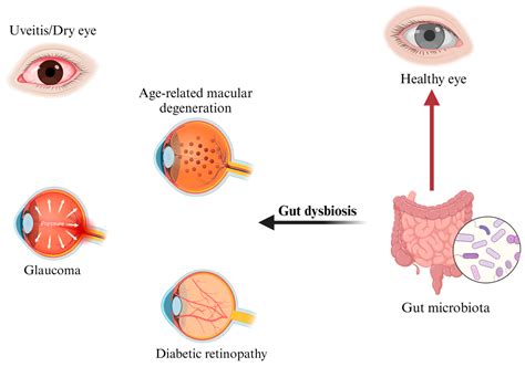 Targeting The Gut Eye Axis An Emerging Strategy To Face Ocular Diseases