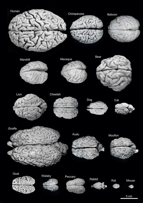 Variability Of Brain Size And External Topography Photographs And Variability Of Brain Size And External Topography Photographs And